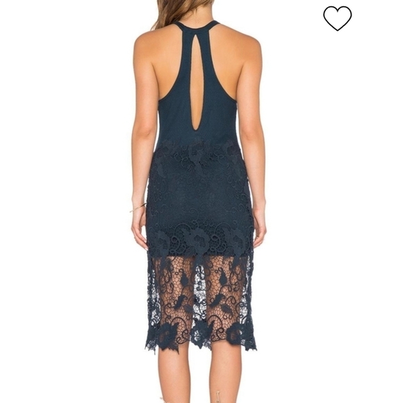 Free People Cotton Modal Nora Lace Overlay Tank Dress•XS - Picture 3 of 12